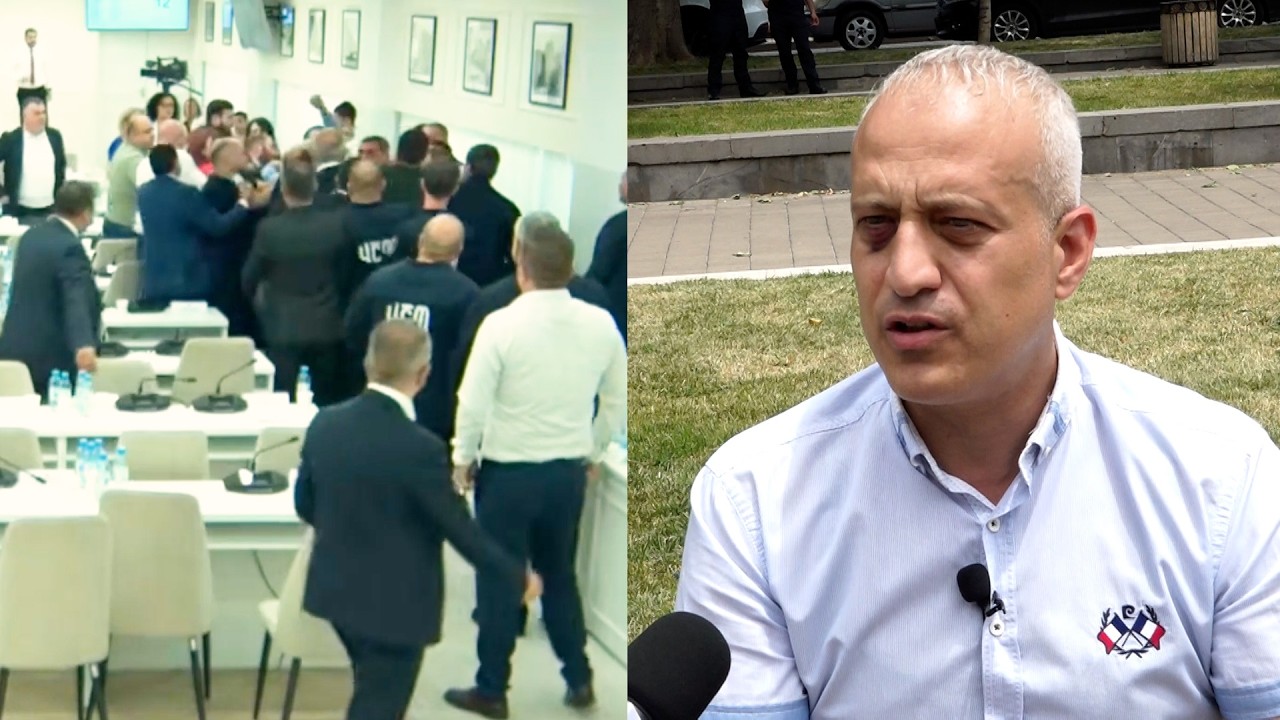 Ոհմակով շակալների պես հարձակվել էին մեզ վրա, 20-ից 40 հոգով մեկի դեմ էին. Սարգիս Տեր-Եսայան